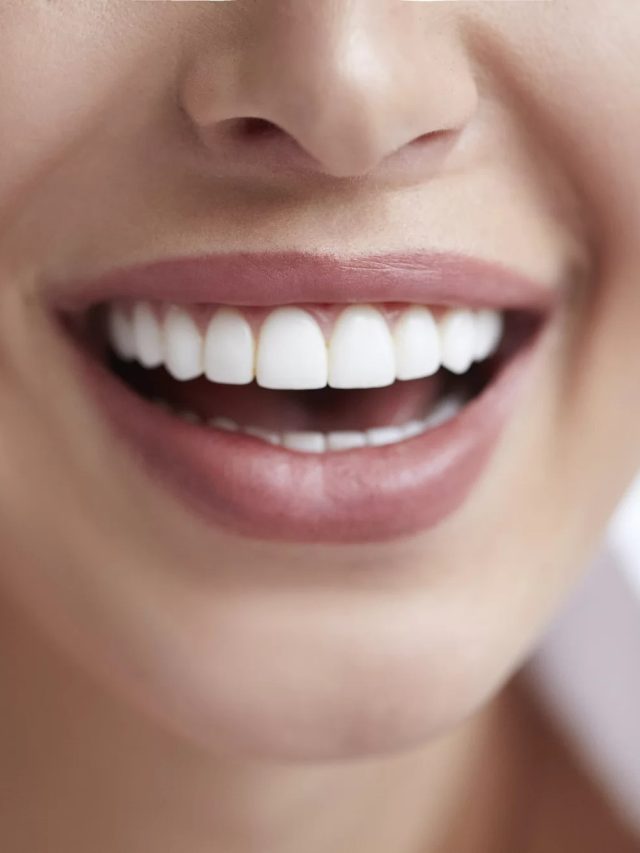 Veneers can help you regain your gorgeous smile!