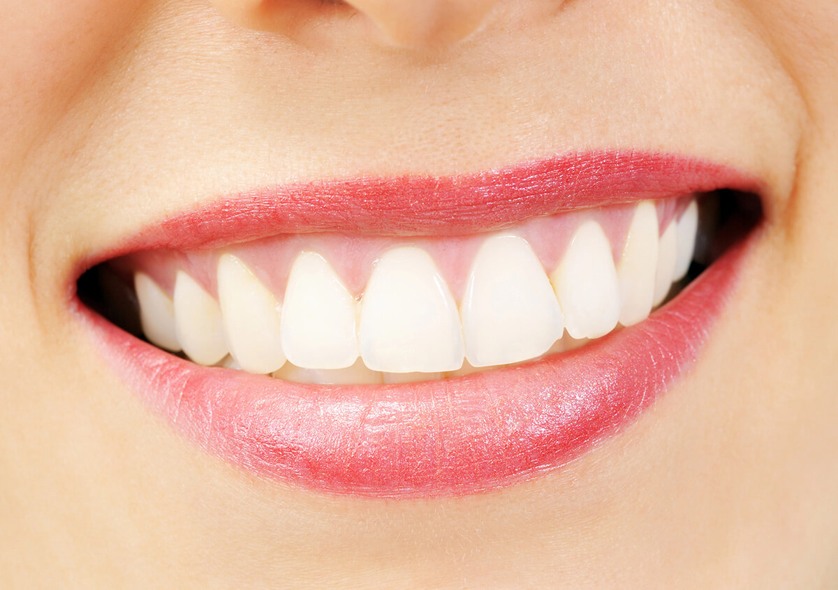 Bright white smile close-up
