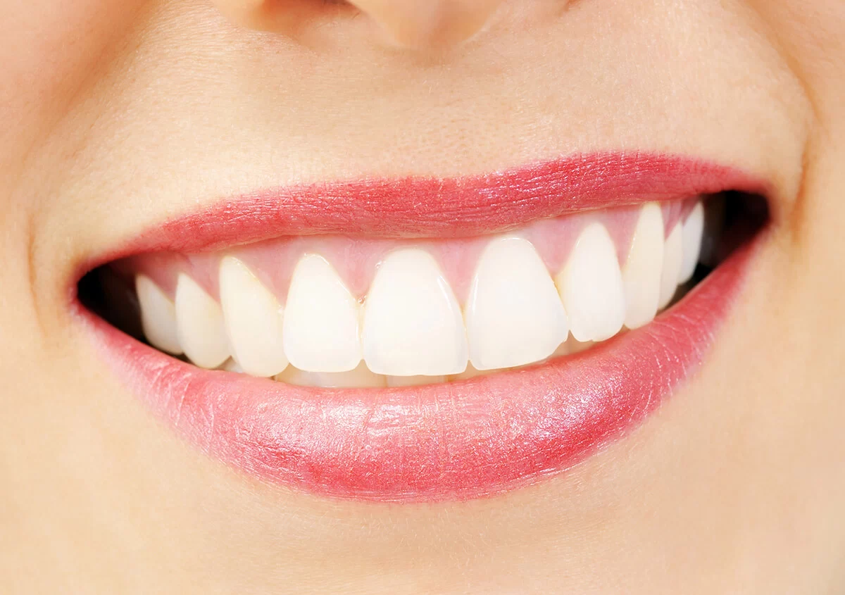 Bright white smile close-up