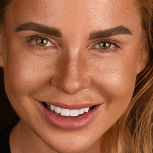 Patient Smile 2
