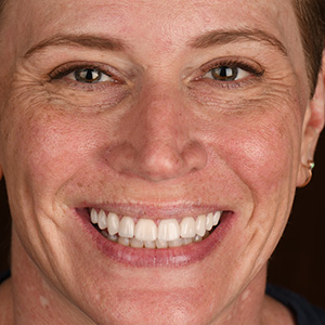 Patient Smile 1