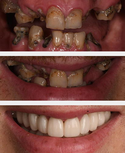 Chris, Before and After Treatment Dental Case 02