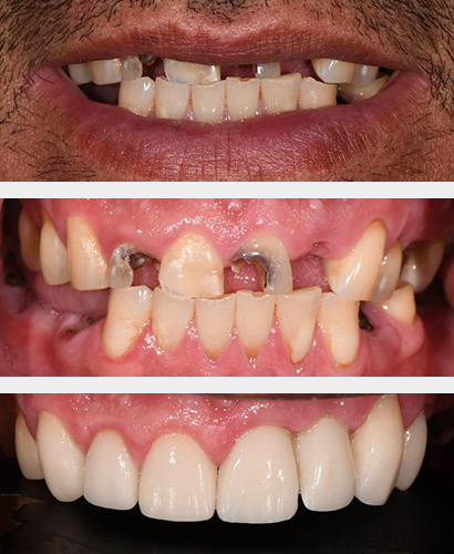 Clemente, Before and After Treatment Dental Case 01 Full 01