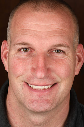 Full Face Smiles Image 03 - Walden Dental