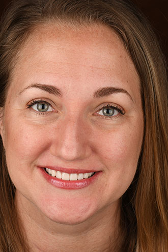 Full Face Smiles Image 04 - Walden Dental