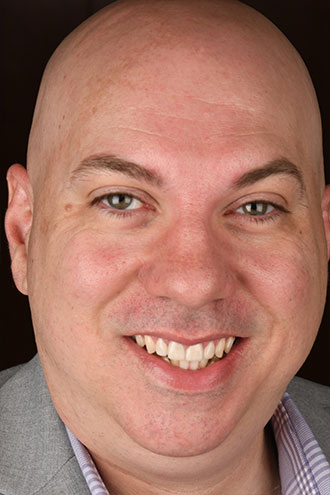 Full Face Smiles Image 05- Walden Dental