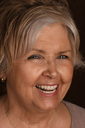 Full Face Smiles Image 06 - Walden Dental