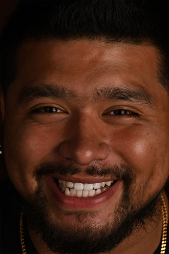Full Face Smiles Image 07 - Walden Dental