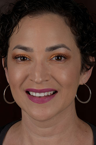 Sonya - Walden Dental