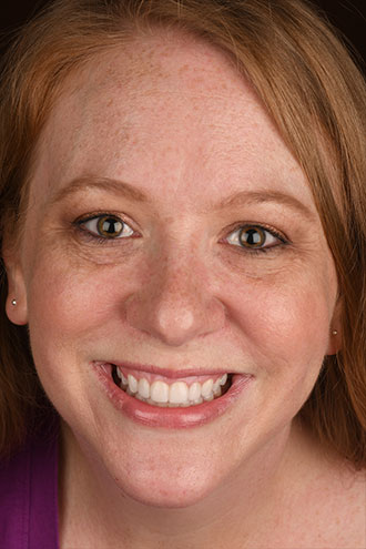 Full Face Smiles Image 11 - Walden Dental