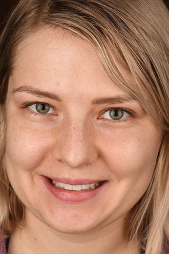 Full Face Smiles Image 13 - Walden Dental