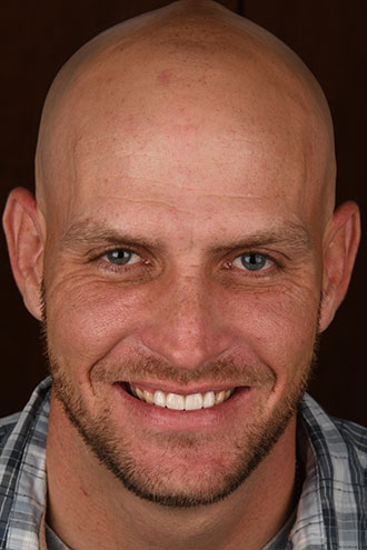 Full Face Smiles Image 15 - Walden Dental