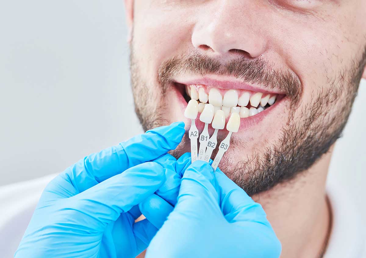 Getting Teeth Veneers in Austin TX Area