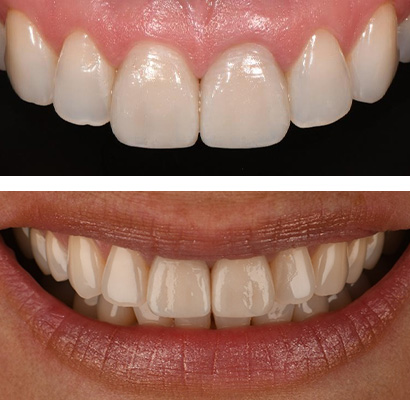 Maria, Before Treatment Dental Case 03