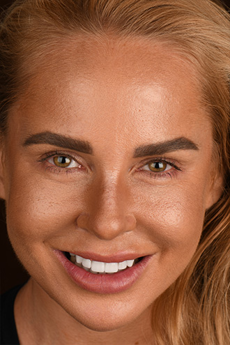 Full Face Smiles Image 21 - Walden Dental