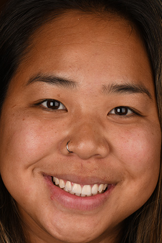 Full Face Smiles Image 22 - Walden Dental