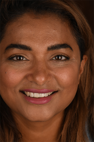 Full Face Smiles Image 27 - Walden Dental