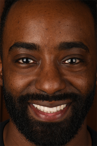 Full Face Smiles Image 30 - Walden Dental