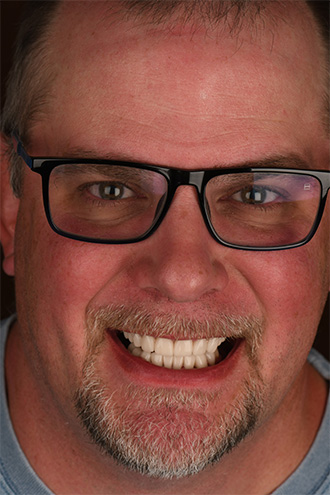 Full Face Smiles Image 30 - Walden Dental