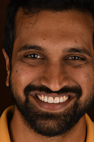 Full Face Smiles Image 32 - Walden Dental