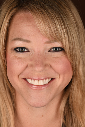 Full Face Smiles Image 33 - Walden Dental