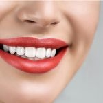 Teeth Whitening Service Austin
